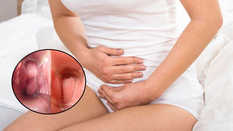 Hướng dẫn cách đặt thuốc vùng kín an toàn, đúng cách