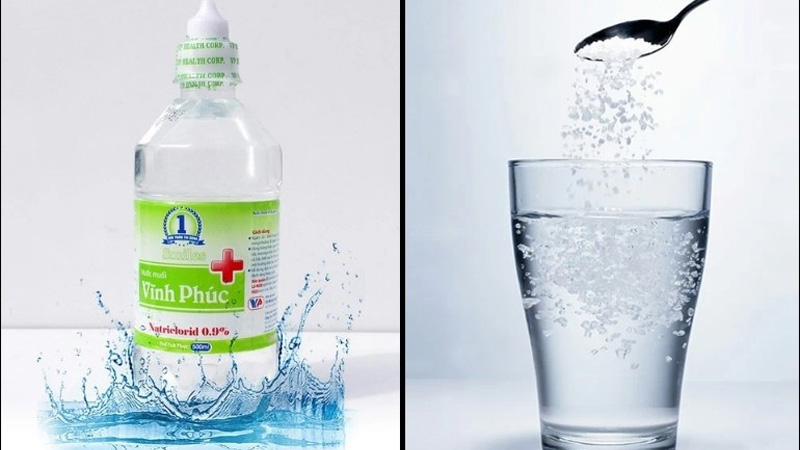 TOP 5 sản phẩm nước muối vệ sinh vùng kín an toàn, sạch sẽ