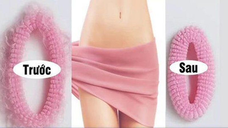 Công dụng và cách đặt viên đặt se khít âm đạo