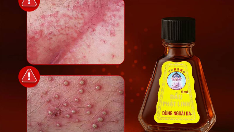 Thực hư cách quan hệ lâu ra bằng kem đánh răng và dầu gió