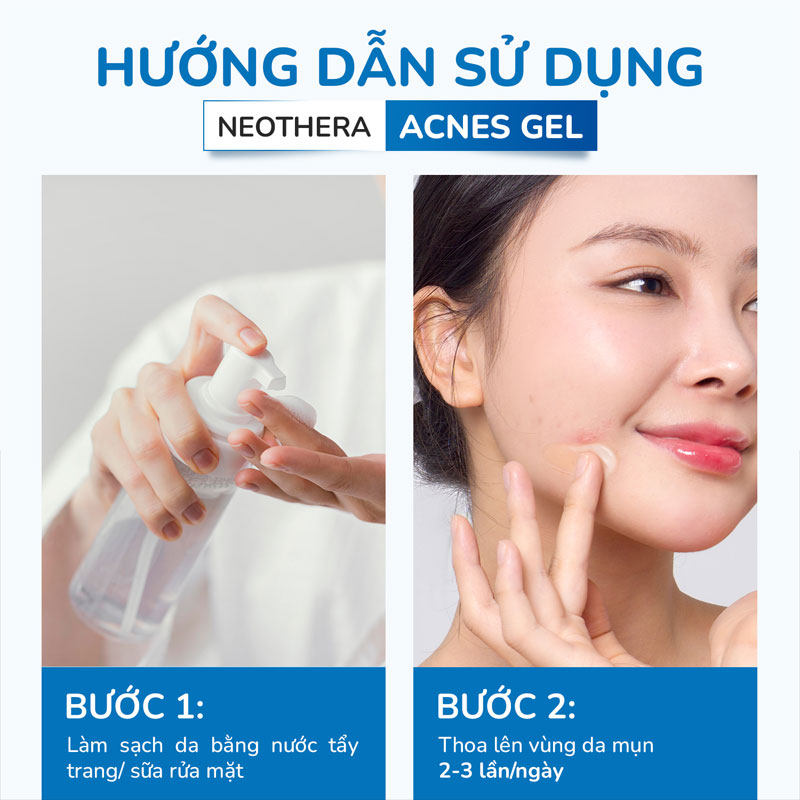 Gel Acnes trị mụn có hiệu quả không? Review chi tiết từ A - Z