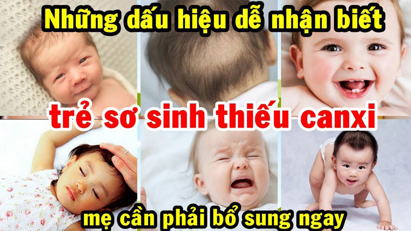 Top 5 loại canxi cho trẻ sơ sinh từ 0-6 tháng tuổi tốt nhất hiện nay