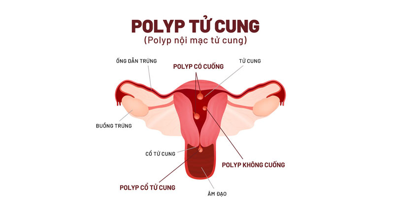 Quan hệ xong bị ra máu là bị gì? Có nguy hiểm không