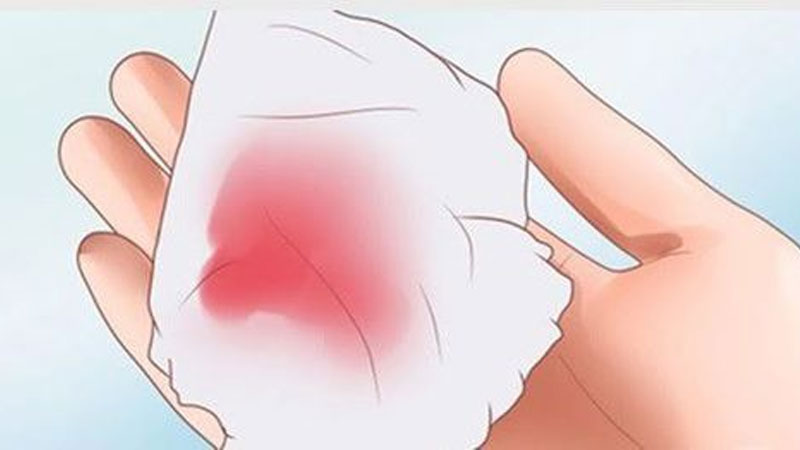Nguyên nhân quan hệ xong ra máu màu hồng nhạt và cách xử lý