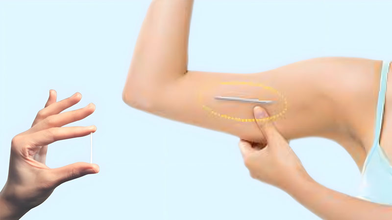 Quan hệ xong uống nước dừa có thai không?