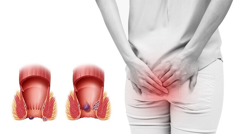 Nếu quan hệ xong bị đau những khu vực này không nên chủ quan