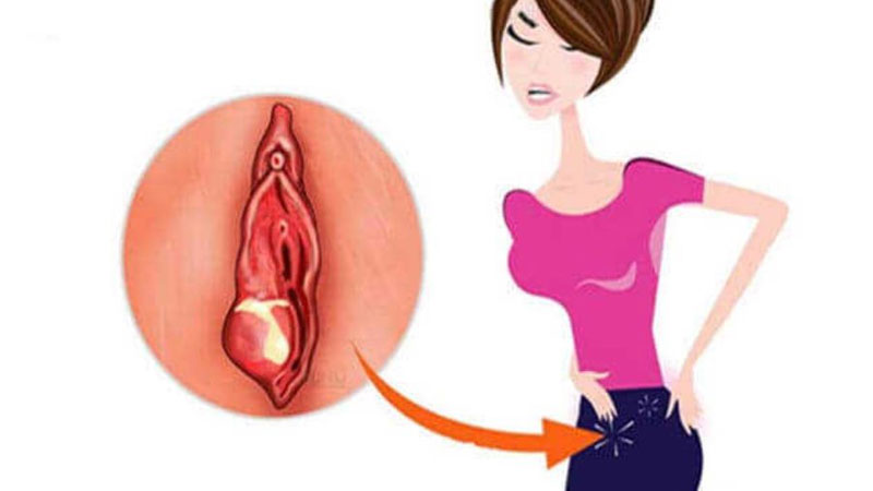 Nếu quan hệ xong bị đau những khu vực này không nên chủ quan