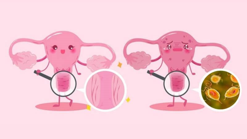 Nguyên nhân quan hệ xong có mùi hôi và cách khắc phục