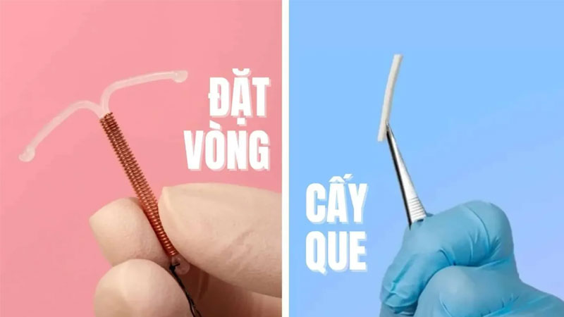 Sau khi quan hệ xong đi rửa liền có thai không?