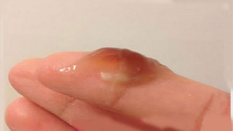 Phụ nữ quan hệ xong ra dịch nâu có nguy hiểm không?