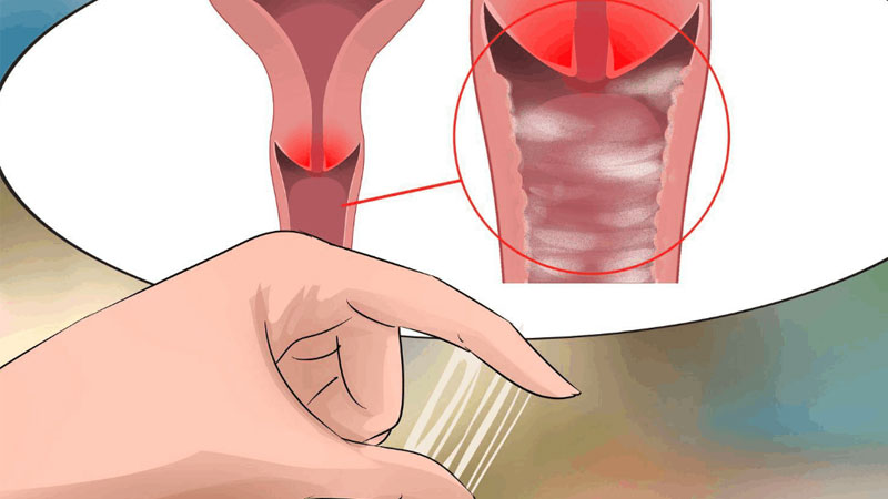 Vì sao quan hệ xong ra dịch trắng? Có nguy hiểm không?