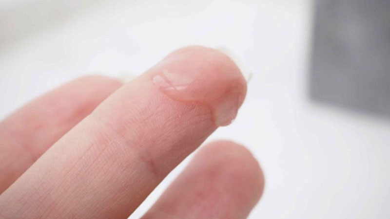 Vì sao quan hệ xong ra dịch trắng? Có nguy hiểm không?