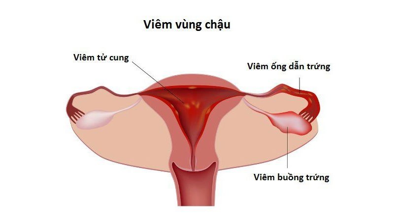 Vì sao quan hệ xong ra dịch trắng? Có nguy hiểm không?