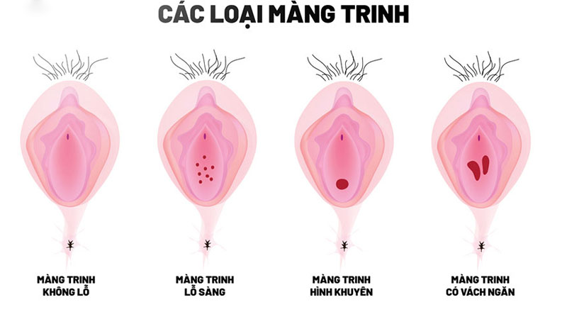 Góc giải đáp: lần đầu quan hệ có ra máu không?