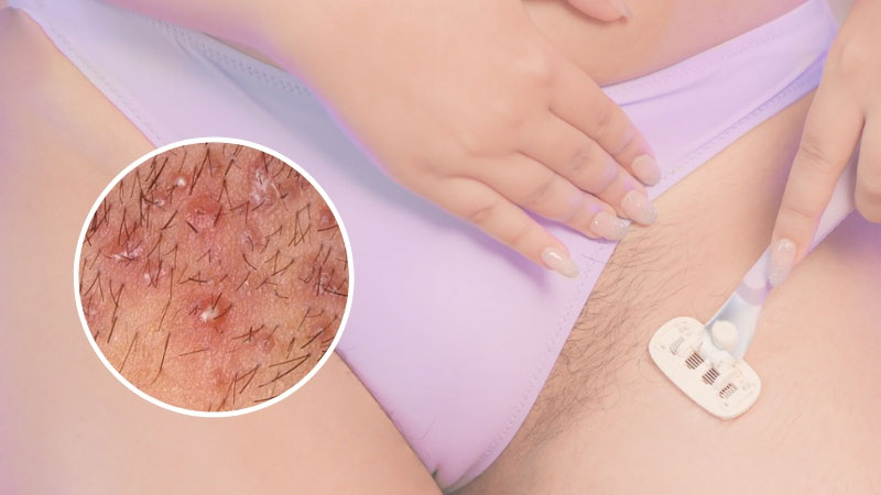 cach tia long vung kin nu tai nha 1 cach tia long vung kin nu tai nha 1