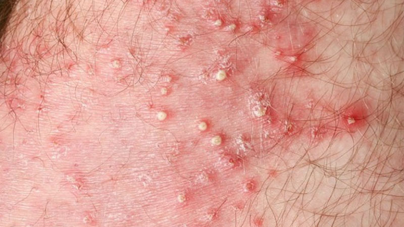 Dị ứng với sản phẩm chăm sóc da