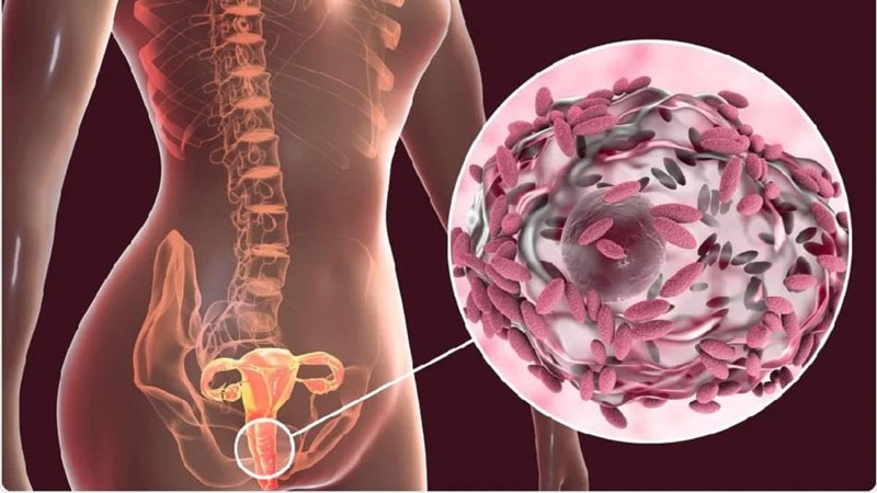 Viêm âm đạo và các bệnh lây truyền qua đường tình dục