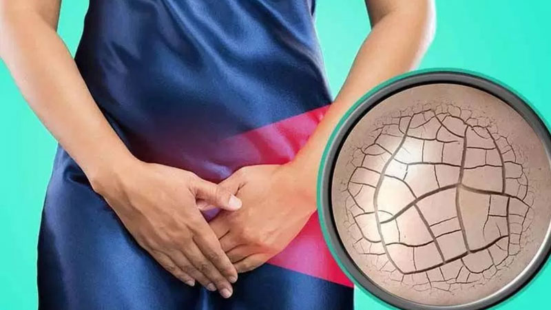 Phụ nữ trong giai đoạn mãn kinh thường gặp tình trạng khô âm đạo