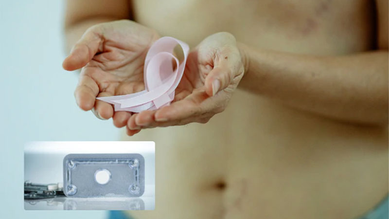 tac dung phu cua thuoc tranh thai khan cap 1 Các tác dụng phụ của thuốc tránh thai khẩn cấp thường chỉ kéo dài trong thời gian ngắn.