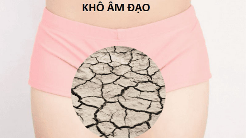 Khô âm đạo, thiếu chất bôi trơn